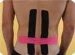 Fisioterapia kinesiotaping domicilio